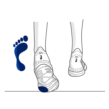 Supination/ Under-Pronation – RUNNERS SPORTS